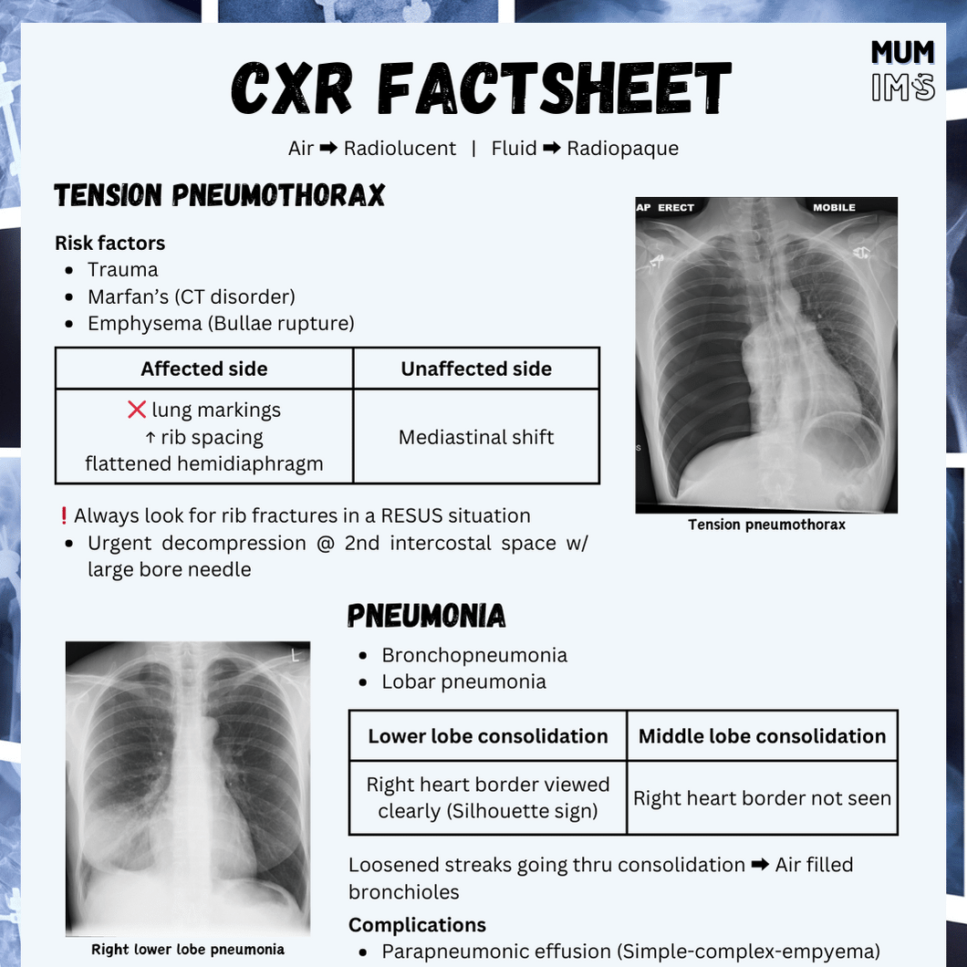 CXR Factsheet